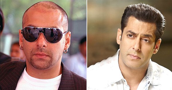 6 Bollywood Celebs Who Got Hair Transplants