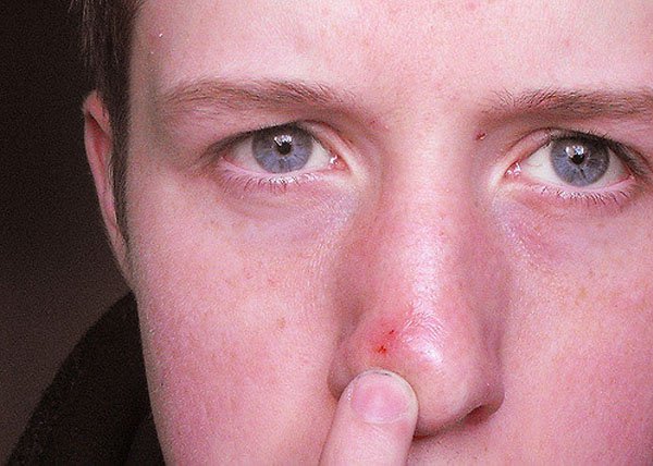 On Nose