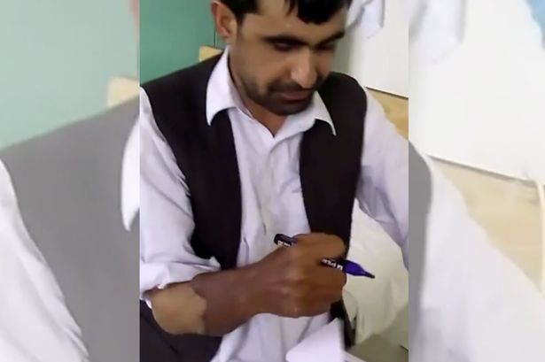 Afghan-captain-Abdul-Rahim-gets-a-new-pair-of-hands-at-armita-hospital