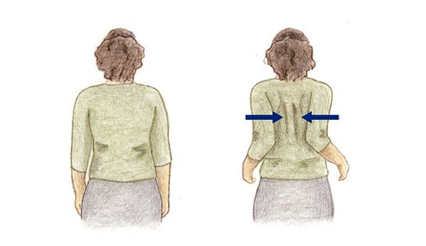 Squeeze your shoulder blades to relax your back!