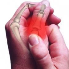 Numb thumb