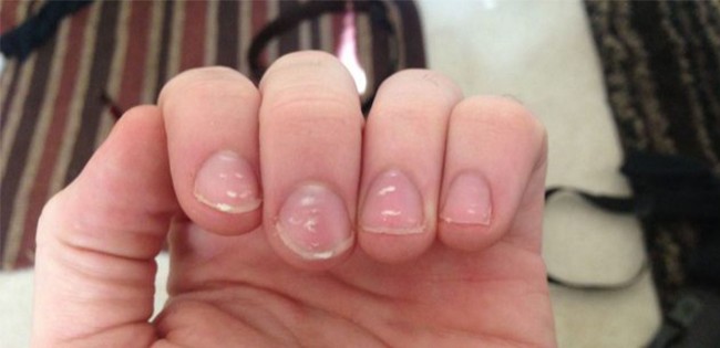 If You See A White Spot On Your Nail, Here's What It Really Means